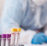 Новый очаг коронавируса выявлен в Псковской области - Pln-Pskov.Ru