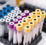 Эксперт спрогнозировал спад заболеваемости гриппом в России после новогодних праздников - Pln-Pskov.Ru