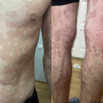 Фото предоставлено комитетом по здравоохранению Псковской области