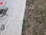 В Псковском районе девочка выпала с балкона третьего этажа
